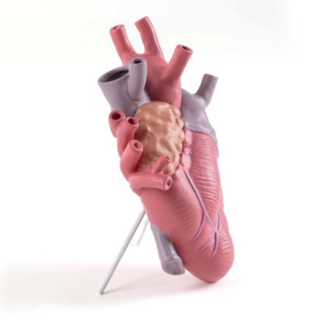Heart Vase 